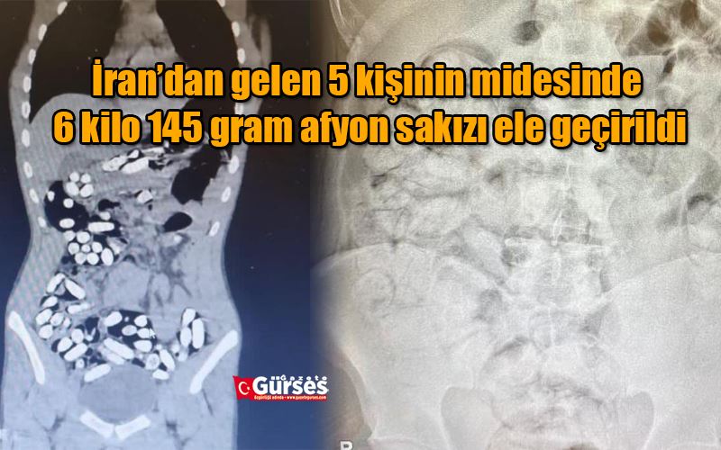 İran’dan gelen 5 kişinin midesinde 6 kilo 145 gram afyon sakızı ele geçirildi