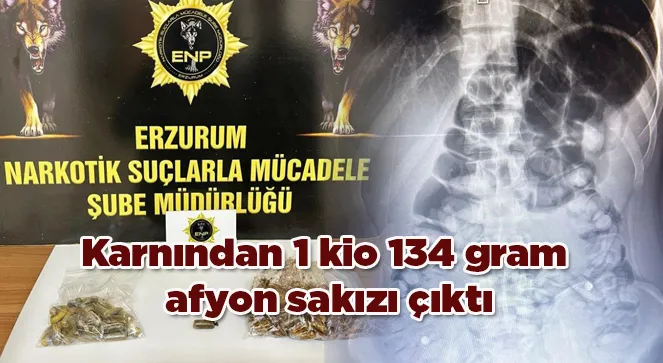 Karnından 1 kio 134 gram afyon sakızı çıktı