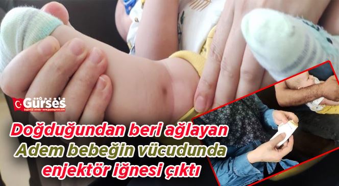 Doğduğundan beri ağlayan Adem bebeğin vücudunda enjektör iğnesi çıktı