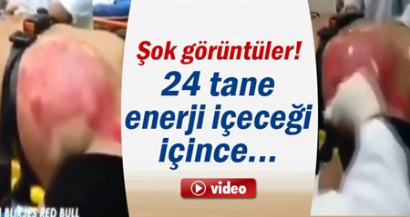 24 tane enerji içecigi içen adamin sok görüntüsü