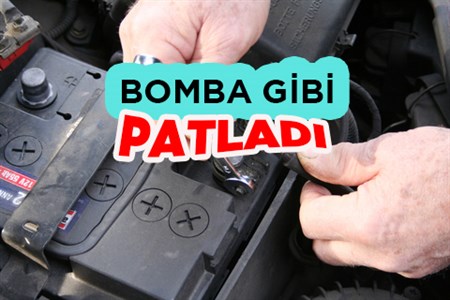 Akü bomba gibi patladi: 1 yarali