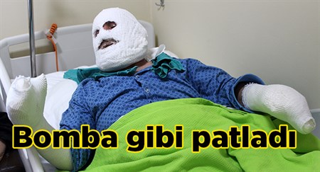 Biriken gaz bomba gibi patladi