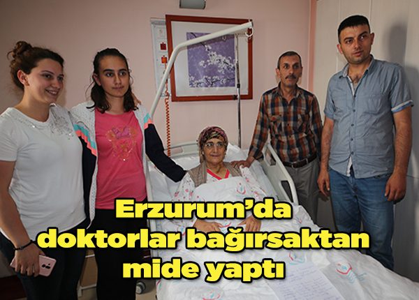 Erzurum’da doktorlar bagirsaktan mide yapti