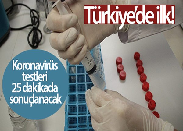 Türkiye’de ilk! Koronavirüs testleri 25 dakikada sonuçlanacak