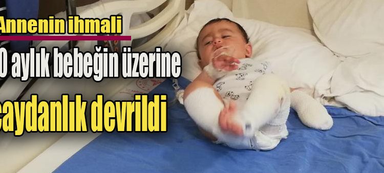 10 aylik bebegin üzerine çaydanlik devrildi