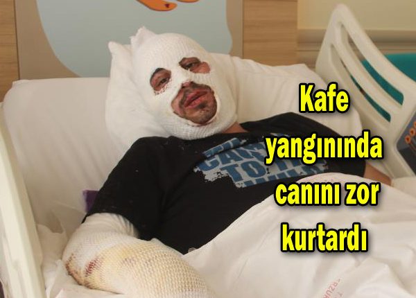 Kafe yangininda canini zor kurtardi